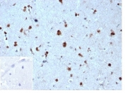 IHC staining of FFPE human brain tissue with p27Kip1 antibody (clone KIP1/1357) at 2ug/ml in PBS for 30min RT. Negative control inset: PBS instead of primary antibody to control for secondary binding. HIER: boil tissue sections in pH 9 10mM Tris with 1mM EDTA for 20 min and allow to cool before testing.
