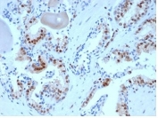 IHC staining of FFPE human prostate tissue using (clone KIP1/1357) at 2ug/ml in PBS for 30min RT. HIER: boil tissue sections in pH 9 10mM Tris with 1mM EDTA for 20 min and allow to cool before testing.