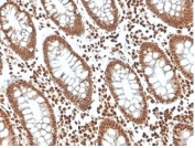 IHC staining of FFPE human colon tissue with p27Kip1 antibody (clone KIP1/1357) at 2ug/ml in PBS for 30min RT. HIER: boil tissue sections in pH 9 10mM Tris with 1mM EDTA for 20 min and allow to cool before testing.