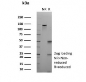 SDS-PAGE analysis of purified, BSA-free recombinant ALDH1A1 antibody (clone rALDH1A1/7285) as confirmation of integrity and purity.