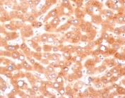 IHC staining of FFPE human liver tissue with Alpha-1-Antichymotrypsin antibody (clone SERPINA3/4187). HIER: boil tissue sections in pH 9 10mM Tris with 1mM EDTA for 20 min and allow to cool before testing.