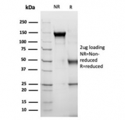 SDS-PAGE analysis of purified, BSA-free Alpha-1-Antichymotrypsin antibody (clone SERPINA3/4189) as confirmation of integrity and purity.