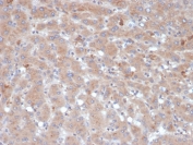 IHC staining of FFPE human liver tissue with Alpha-1-Antichymotrypsin antibody (clone SERPINA3/4189). HIER: boil tissue sections in pH 9 10mM Tris with 1mM EDTA for 20 min and allow to cool before testing.