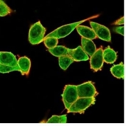 Immunofluorescent staining of PFA-fixed human HeLa cells using Daxx antibody (green, clone PCRP-DAXX-6A8) and phalloidin (red).