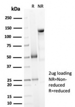 SDS-PAGE analysis of purified, BSA-free DCN antibody (clone DCN/7031R) as confirmation of integrity and purity.