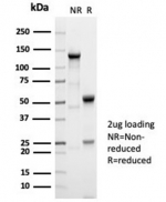 SDS-PAGE analysis of purified, BSA-free recombinant Alpha Fetoprotein antibody (clone AFP/7007R) as confirmation of integrity and purity.