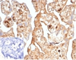 IHC staining of FFPE human placental tissue with recombinant Alpha Fetoprotein antibody (clone AFP/7007R) at 2ug/ml in PBS for 30min RT. Cytoplasmic staining observed. Negative control inset: PBS used instead of primary antibody to control for secondary Ab binding. HIER: boil tissue sections in pH 9 10mM Tris with 1mM EDTA for 20 min and allow to cool before testing.