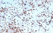 IHC staining of FFPE human spleen tissue with recombinant GZMB antibody (clone rGZMB/4538). HIER: boil tissue sections in pH 9 10mM Tris with 1mM EDTA for 20 min and allow to cool before testing.