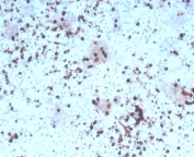 IHC staining of FFPE human tonsil tissue with recombinant GZMB antibody (clone rGZMB/4538). HIER: boil tissue sections in pH 9 10mM Tris with 1mM EDTA for 20 min and allow to cool before testing.