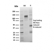 SDS-PAGE analysis of purified, BSA-free DNTT antibody (clone rDNTT/6909) as confirmation of integrity and purity.