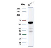 Western blot testing of human brain tissue lysate using recombinant Aldehyde Dehydrogenase 1A1 antibody (clone ALDH1A1/7011R). Expected molecular weight ~55 kDa.