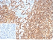 IHC staining of FFPE human tonsil tissue with recombinant CD20 antibody (clone rMS4A1/7280) at 2ug/ml. Negative control inset: PBS instead of primary antibody to control for secondary binding. HIER: boil tissue sections in pH 9 10mM Tris with 1mM EDTA for 20 min and allow to cool before testing.