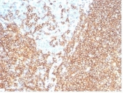 IHC staining of FFPE human tonsil tissue with recombinant CD20 antibody (clone rMS4A1/7280) at 2ug/ml. HIER: boil tissue sections in pH 9 10mM Tris with 1mM EDTA for 20 min and allow to cool before testing.