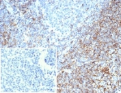 IHC staining of FFPE human tonsil tissue with recombinant CD35 antibody (clone rCR1/7289) at 2ug/ml. Negative control inset: PBS instead of primary antibody to control for secondary binding. HIER: boil tissue sections in pH 9 10mM Tris with 1mM EDTA for 20 min and allow to cool before testing.