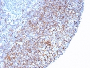 IHC staining of FFPE human tonsil tissue with recombinant CD35 antibody (clone rCR1/7289) at 2ug/ml. HIER: boil tissue sections in pH 9 10mM Tris with 1mM EDTA for 20 min and allow to cool before testing.