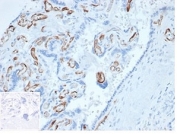 IHC staining of FFPE human placental tissue with FABP4 antibody (clone FABP4/4423) at 2ug/ml. Negative control inset: PBS instead of primary antibody to control for secondary binding. HIER: boil tissue sections in pH 9 10mM Tris with 1mM EDTA for 20 min and allow to cool before testing.