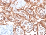 IHC staining of FFPE human placental tissue with Fibroblast Activation Protein Alpha antibody (clone FAP/4853). Negative control inset: PBS instead of primary antibody to control for secondary binding. HIER: boil tissue sections in pH 9 10mM Tris with 1mM EDTA for 20 min and allow to cool before testing.