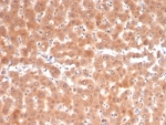 IHC staining of FFPE human liver tissue with Fibroblast Activation Protein antibody (clone FAP/4853). HIER: boil tissue sections in pH 9 10mM Tris with 1mM EDTA for 20 min and allow to cool before testing.