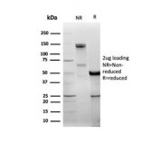 SDS-PAGE analysis of purified, BSA-free RHOBTB2 antibody (clone DBC2/3361) as confirmation of integrity and purity.
