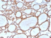 IHC staining of FFPE human thyroid tissue with RHOBTB2 antibody (clone DBC2/3361) at 2ug/ml in PBS for 30min RT. HIER: boil tissue sections in pH 9 10mM Tris with 1mM EDTA for 20 min and allow to cool before testing.
