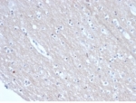 IHC staining of FFPE human brain tissue with SATB2 antibody (clone rSATB2/6929) at 2ug/ml in PBS for 30min RT. HIER: boil tissue sections in pH 9 10mM Tris with 1mM EDTA for 20 min and allow to cool before testing.