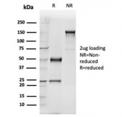 SDS-PAGE analysis of purified, BSA-free VDBP antibody (clone VDBP/4481) as confirmation of integrity and purity.