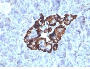 IHC staining of FFPE human renal oncocytoma with VDBP antibody (clone VDBP/4481) at 2ug/ml in PBS for 30min RT. HIER: boil tissue sections in pH 9 10mM Tris with 1mM EDTA for 20 min and allow to cool before testing.