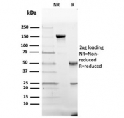 SDS-PAGE analysis of purified, BSA-free Vitamin D binding protein antibody (clone VDBP/4482) as confirmation of integrity and purity.