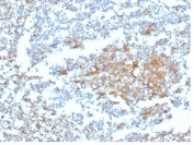 IHC staining of FFPE human tonsil tissue with Vitamin D binding protein antibody (clone VDBP/4482) at 2ug/ml in PBS for 30min RT. HIER: boil tissue sections in pH 9 10mM Tris with 1mM EDTA for 20 min and allow to cool before testing.