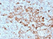 IHC staining of FFPE human pancreatic tissue with Vitamin D binding protein antibody (clone VDBP/4482) at 2ug/ml in PBS for 30min RT. HIER: boil tissue sections in pH 9 10mM Tris with 1mM EDTA for 20 min and allow to cool before testing.