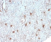 IHC staining of FFPE human cerebellum tissue with GFAP antibody (clone GFAP/6879). HIER: boil tissue sections in pH 9 10mM Tris with 1mM EDTA for 20 min and allow to cool before testing.