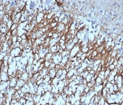 IHC staining of FFPE human cerebellum tissue with GFAP antibody (clone GFAP/6879). HIER: boil tissue sections in pH 9 10mM Tris with 1mM EDTA for 20 min and allow to cool before testing.