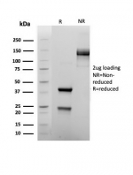 SDS-PAGE analysis of purified, BSA-free FOXP1 antibody (clone rFOXP1/6902) as confirmation of integrity and purity.