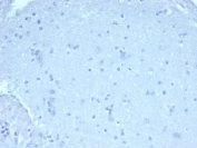 Negative control: IHC staining of FFPE human brain tissue using FOXP1 antibody (clone rFOXP1/6902) at 1ug/ml in PBS for 30min RT. HIER: boil tissue sections in pH 9 10mM Tris with 1mM EDTA for 20 min and allow to cool before testing.