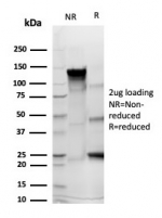 SDS-PAGE analysis of purified, BSA-free SPN antibody (clone rSPN/6563) as confirmation of integrity and purity.