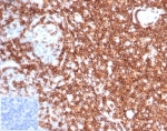 IHC staining of FFPE human tonsil tissue with SPN antibody (clone rSPN/6563) at 2ug/ml. Negative control inset: PBS instead of primary antibody to control for secondary binding. HIER: boil tissue sections in pH 9 10mM Tris with 1mM EDTA for 20 min and allow to cool before testing.