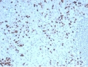 IHC staining of FFPE human tonsil tissue with recombinant Granzyme B antibody (clone GZMB/4539R). HIER: boil tissue sections in pH 9 10mM Tris with 1mM EDTA for 20 min and allow to cool before testing.