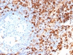 IHC staining of FFPE human tonsil tissue with Annexin A1 antibody (clone ANXA1/6452R). HIER: boil tissue sections in pH 9 10mM Tris with 1mM EDTA for 20 min and allow to cool before testing.