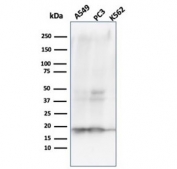 Western blot analysis of human A549, PC3 and K562 cell lysates using NM23 antibody (clone NME1/2738). Predicted molecular weight ~17 kDa.