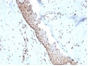 IHC staining of FFPE human cervix tissue with NM23 antibody (clone NME1/2738). HIER: boil tissue sections in pH 9 10mM Tris with 1mM EDTA for 20 min and allow to cool before testing.