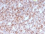 IHC staining of FFPE human spleen tissue with RETN antibody (clone RETN/4327). HIER: boil tissue sections in pH 9 10mM Tris with 1mM EDTA for 20 min and allow to cool before testing.