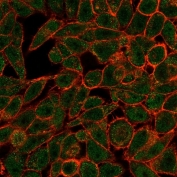 Immunofluorescent staining of human HeLa cells using Bcl6 antibody (green, clone PCRP-BCL6-1D3) and phalloidin (red).