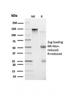 SDS-PAGE analysis of purified, BSA-free Bcl6 antibody (clone PCRP-BCL6-1D3) as confirmation of integrity and purity.
