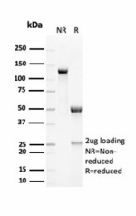 SDS-PAGE analysis of purified, BSA-free recombinant EBAG9 antibody (clone EBAG9/7033R) as confirmation of integrity and purity.