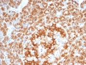 IHC staining of FFPE human salivary gland with recombinant EBAG9 antibody (clone EBAG9/7033R). HIER: boil tissue sections in pH 9 10mM Tris with 1mM EDTA for 20 min and allow to cool before testing.