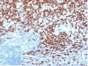 IHC staining of FFPE human tonsil tissue with recombinant CD5 antibody (clone C5/4516R) at 2ug/ml in PBS for 30min RT. Strong surface staining observed. Negative control inset: PBS used instead of primary antibody to control for secondary Ab binding. HIER: boil tissue sections in pH 9 10mM Tris with 1mM EDTA for 20 min and allow to cool before testing.