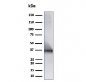Western blot analysis of human Raji cell lysate using recombinant CD20 antibody (clone IGEL/6850R). Predicted molecular weight ~33 kDa.