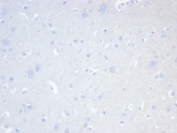 Negative control: IHC staining of FFPE human brain tissue with recombinant CD20 antibody (clone MS4A1/7015R) at 2ug/ml in PBS for 30min RT. HIER: boil tissue sections in pH 9 10mM Tris with 1mM EDTA for 20 min and allow to cool before testing.