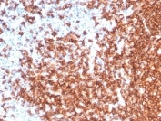 IHC staining of FFPE human tonsil tissue with recombinant CD20 antibody (clone MS4A1/7015R). HIER: boil tissue sections in pH 9 10mM Tris with 1mM EDTA for 20 min and allow to cool before testing. HIER: boil tissue sections in pH 9 10mM Tris with 1mM EDTA for 20 min and allow to cool before testing.