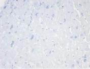 Negative control: IHC staining of FFPE human heart tissue with recombinant CD20 antibody (clone MS4A1/7015R) at 2ug/ml in PBS for 30min RT. HIER: boil tissue sections in pH 9 10mM Tris with 1mM EDTA for 20 min and allow to cool before testing.